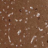 Anti-WDR37 antibody produced in rabbit Prestige Antibodies® Powered by Atlas Antibodies, affinity isolated antibody, buffered aqueous glycerol solution