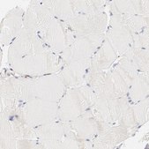 Anti-CTSH antibody produced in rabbit Prestige Antibodies® Powered by Atlas Antibodies, affinity isolated antibody, buffered aqueous glycerol solution