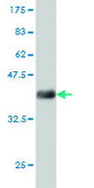 Monoclonal Anti-CDC42BPB antibody produced in mouse clone 5F12, purified immunoglobulin, buffered aqueous solution
