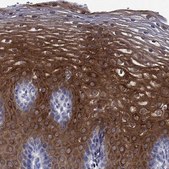 Anti-SULT2B1 antibody produced in rabbit Prestige Antibodies® Powered by Atlas Antibodies, affinity isolated antibody, buffered aqueous glycerol solution