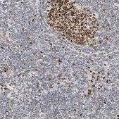 Anti-CUX1 antibody produced in rabbit Prestige Antibodies® Powered by Atlas Antibodies, affinity isolated antibody, buffered aqueous glycerol solution