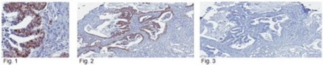 Anticuerpo anti-SIRT1, clon 10E4 clone 10-E-4, from mouse
