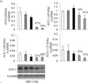 Anti-AUF1 Antibody Upstate®, from rabbit
