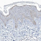 Anti-MYOT antibody produced in rabbit Prestige Antibodies® Powered by Atlas Antibodies, affinity isolated antibody, buffered aqueous glycerol solution