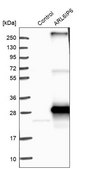 Anti-ARL6IP6 antibody produced in rabbit Prestige Antibodies® Powered by Atlas Antibodies, affinity isolated antibody, buffered aqueous glycerol solution