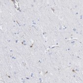 Anti-GIMAP4 antibody produced in rabbit Prestige Antibodies® Powered by Atlas Antibodies, affinity isolated antibody, buffered aqueous glycerol solution, Ab2
