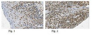 Anti-TCF12 Antibody from rabbit, purified by affinity chromatography