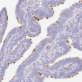 Anti-LDLRAD1 antibody produced in rabbit Prestige Antibodies® Powered by Atlas Antibodies, affinity isolated antibody, buffered aqueous glycerol solution