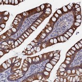 Anti-IL7 antibody produced in rabbit Prestige Antibodies® Powered by Atlas Antibodies, affinity isolated antibody, buffered aqueous glycerol solution