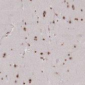Anti-CDYL antibody produced in rabbit Prestige Antibodies® Powered by Atlas Antibodies, affinity isolated antibody, buffered aqueous glycerol solution