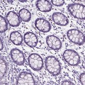 Anti-SPAG6 antibody produced in rabbit Prestige Antibodies® Powered by Atlas Antibodies, affinity isolated antibody, buffered aqueous glycerol solution