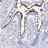 Anti-SLC3A1 antibody produced in rabbit Prestige Antibodies® Powered by Atlas Antibodies, affinity isolated antibody, buffered aqueous glycerol solution