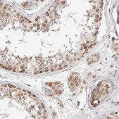 Anti-MRM3 antibody produced in rabbit Prestige Antibodies® Powered by Atlas Antibodies, affinity isolated antibody, buffered aqueous glycerol solution, Ab2