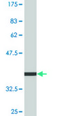 Monoclonal Anti-AAK1 antibody produced in mouse clone 4B10, purified immunoglobulin, buffered aqueous solution