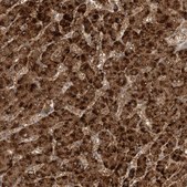 Anti-SCP2 antibody produced in rabbit Prestige Antibodies® Powered by Atlas Antibodies, affinity isolated antibody, buffered aqueous glycerol solution, Ab2