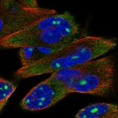 Anti-P2RX6 antibody produced in rabbit Prestige Antibodies® Powered by Atlas Antibodies, affinity isolated antibody, buffered aqueous glycerol solution