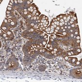 Anti-RAB11FIP1 antibody produced in rabbit Prestige Antibodies® Powered by Atlas Antibodies, affinity isolated antibody, buffered aqueous glycerol solution, Ab3