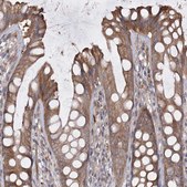 Anti-RIN2 antibody produced in rabbit Prestige Antibodies® Powered by Atlas Antibodies, affinity isolated antibody, buffered aqueous glycerol solution