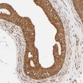 Anti-BCAP31 antibody produced in rabbit Prestige Antibodies® Powered by Atlas Antibodies, affinity isolated antibody, buffered aqueous glycerol solution