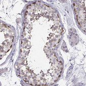 Anti-TSPYL5 antibody produced in rabbit Prestige Antibodies® Powered by Atlas Antibodies, affinity isolated antibody, buffered aqueous glycerol solution