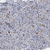Anti-DDX41 antibody produced in rabbit Prestige Antibodies® Powered by Atlas Antibodies, affinity isolated antibody, buffered aqueous glycerol solution