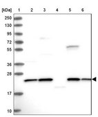Anti-NPVF antibody produced in rabbit Prestige Antibodies® Powered by Atlas Antibodies, affinity isolated antibody, buffered aqueous glycerol solution