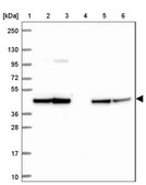 Anti-STOML2 antibody produced in rabbit Prestige Antibodies® Powered by Atlas Antibodies, affinity isolated antibody, buffered aqueous glycerol solution