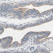 Anti-FAM134A antibody produced in rabbit Prestige Antibodies® Powered by Atlas Antibodies, affinity isolated antibody, buffered aqueous glycerol solution