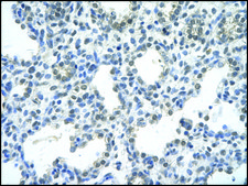 Anti-RASSF7 antibody produced in rabbit IgG fraction of antiserum