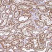 Anti-TIMMDC1 antibody produced in rabbit Prestige Antibodies® Powered by Atlas Antibodies, affinity isolated antibody, buffered aqueous glycerol solution