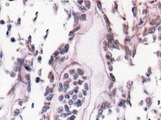 Anti-Bone Sialoprotein II Antibody, CT, clone ID1.2 clone ID1.2, Chemicon®, from mouse