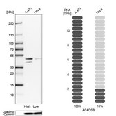 Anti-ACADSB antibody produced in rabbit Prestige Antibodies® Powered by Atlas Antibodies, affinity isolated antibody, buffered aqueous glycerol solution