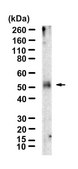 Anti-CCR4/CD194 Antibody, clone 1N13 ZooMAb® Rabbit Monoclonal recombinant, expressed in HEK 293 cells