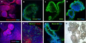 3dGRO® Human iPSC Derived Colon Organoids Normal, Dermal Fibroblast, Age: Neonatal, Male, Mutation: None