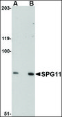 Anti-SPG11 antibody produced in rabbit affinity isolated antibody, buffered aqueous solution