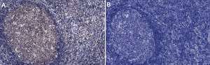 Anti-Caspase 3 Antibody Upstate®, from rabbit