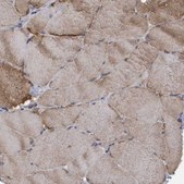 Anti-LRSAM1 antibody produced in rabbit Prestige Antibodies® Powered by Atlas Antibodies, affinity isolated antibody, buffered aqueous glycerol solution, Ab2