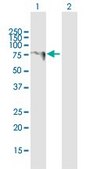 Anti-LARP6 antibody produced in mouse purified immunoglobulin, buffered aqueous solution