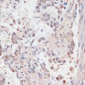 Anti-Phospho-PPP1CA-T320 antibody produced in rabbit
