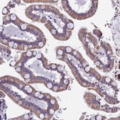 Anti-ACSS1 antibody produced in rabbit Prestige Antibodies® Powered by Atlas Antibodies, affinity isolated antibody, buffered aqueous glycerol solution