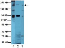 Anti-erbB-2/HER-2 Antibody Upstate®, from rabbit