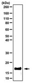 Anti-phospho-Histone H3 (Ser10) Antibody, clone 63-1C-8, Recombinant clone 63-1C-8, from rabbit