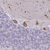 Anti-PITPNM1 antibody produced in rabbit Prestige Antibodies® Powered by Atlas Antibodies, affinity isolated antibody, buffered aqueous glycerol solution
