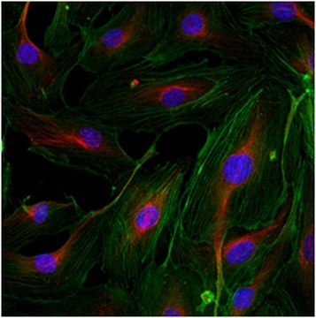 Anti-PHLPP2 Antibody from rabbit, purified by affinity chromatography