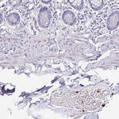 Anti-TLR4 antibody produced in rabbit Prestige Antibodies® Powered by Atlas Antibodies, affinity isolated antibody, buffered aqueous glycerol solution