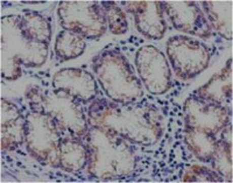 Anti-TSG101, clone 4A10 Antibody