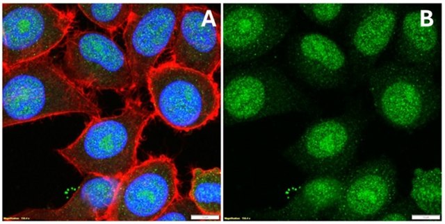 Anti-BPTF Antibody from rabbit, purified by affinity chromatography