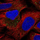 Anti-IRAK2 antibody produced in rabbit Prestige Antibodies® Powered by Atlas Antibodies, affinity isolated antibody, buffered aqueous glycerol solution