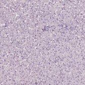Anti-SLC6A17 antibody produced in rabbit Prestige Antibodies® Powered by Atlas Antibodies, affinity isolated antibody, buffered aqueous glycerol solution