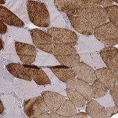 Monoclonal Anti-MYH6 antibody produced in mouse Prestige Antibodies® Powered by Atlas Antibodies, clone CL2162, purified immunoglobulin, buffered aqueous glycerol solution